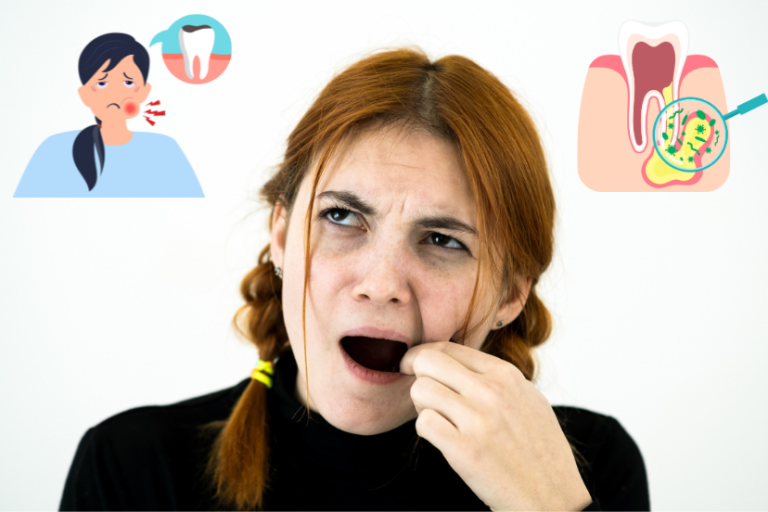 exposed-nerve-in-tooth-nerve-pain-guide