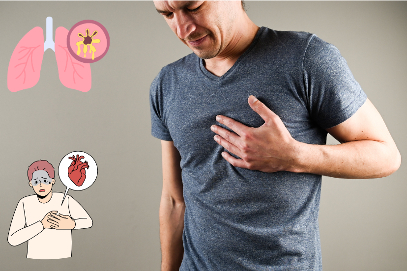 Can A Pinched Nerve Cause Chest Pain