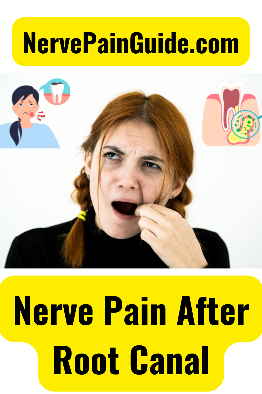 Nerve Pain After Root Canal - Nerve Pain Guide